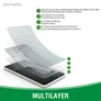 4smarts 360° Starter Set mit X-Pro Clear Glas, Montagerahmen Clear Hülle Pixel 7